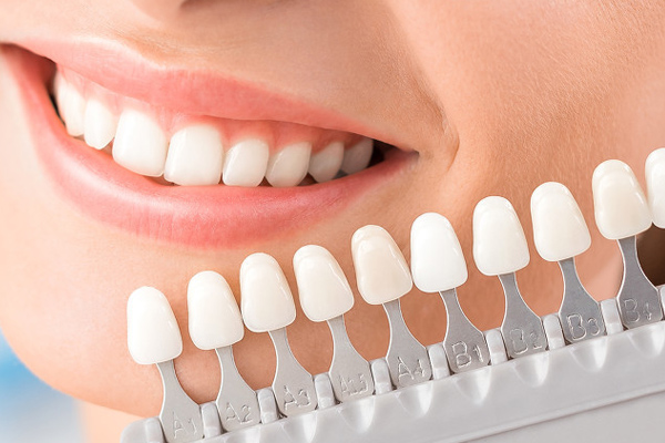 Zijn er bijwerkingen van tanden bleken? Je kent deze drie punten niet